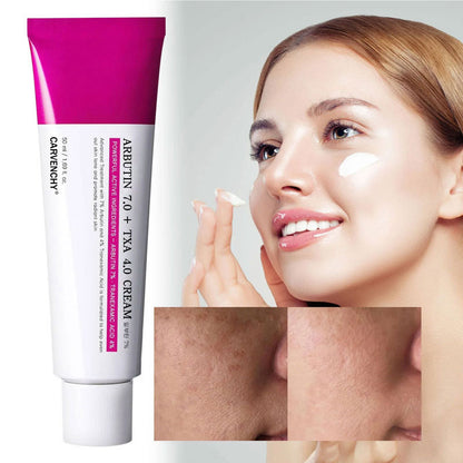 Arbutin 7% & Tranexamic Acid 4% Cream with Niacinamide for Dark Spots & Pigmentation